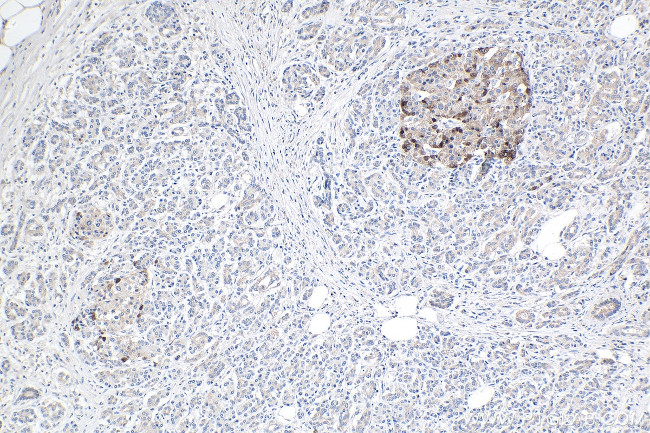 TCN2 Antibody in Immunohistochemistry (Paraffin) (IHC (P))