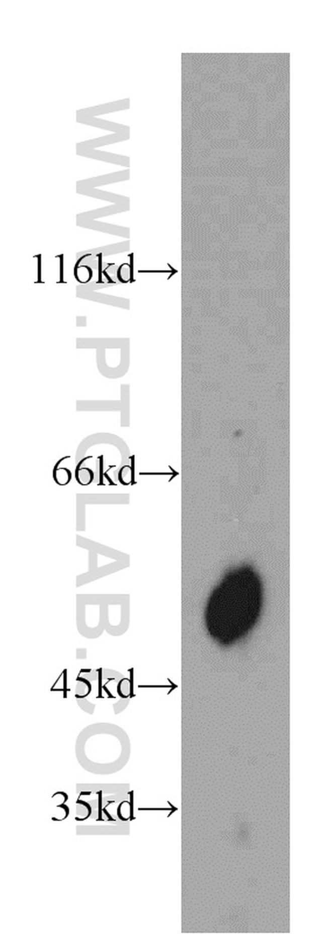 TCN2 Antibody in Western Blot (WB)