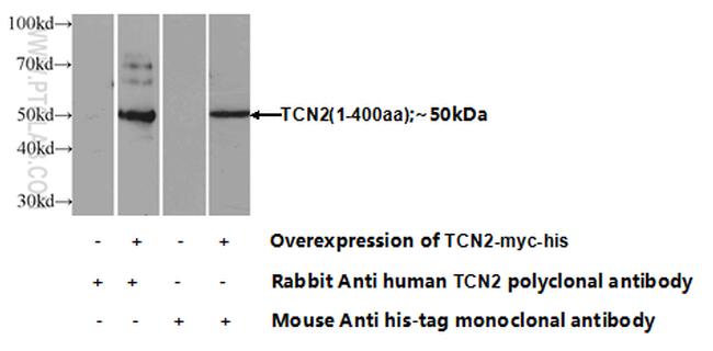 TCN2 Antibody in Western Blot (WB)