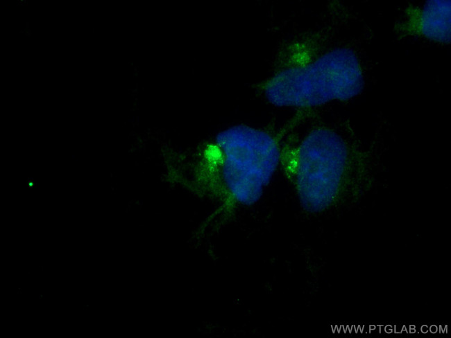 GOPC Antibody in Immunocytochemistry (ICC/IF)