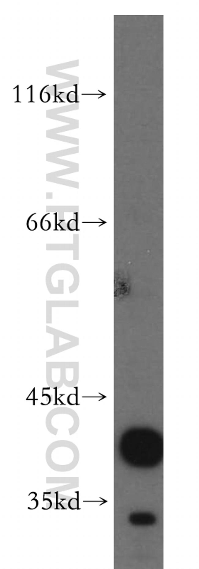 CANT1 Antibody in Western Blot (WB)