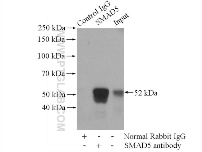 SMAD5 Antibody in Immunoprecipitation (IP)