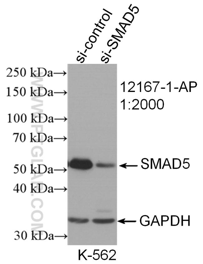 SMAD5 Antibody in Western Blot (WB)