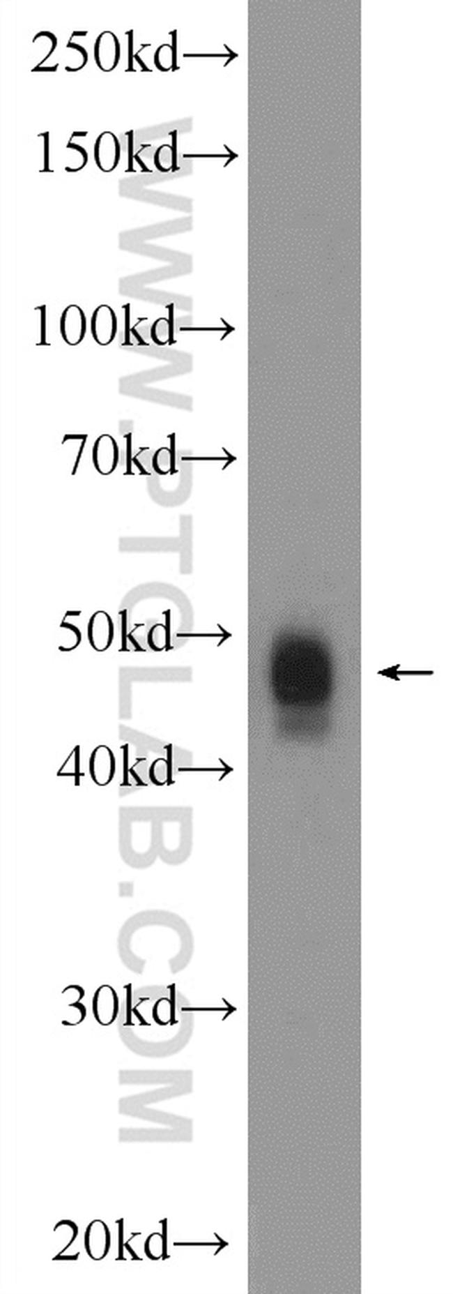 SMAD5 Antibody in Western Blot (WB)