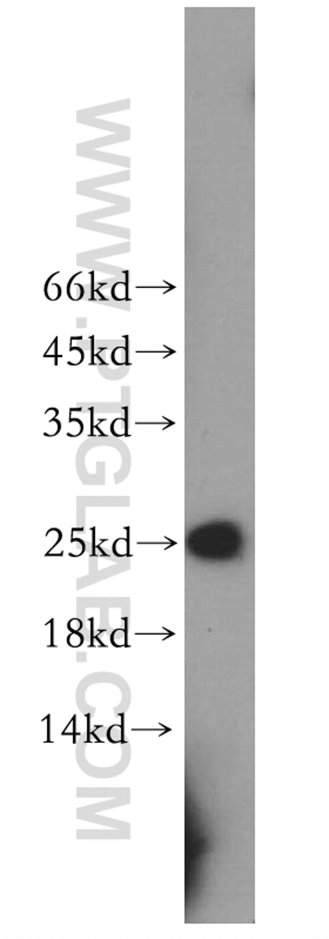 RPE Antibody in Western Blot (WB)