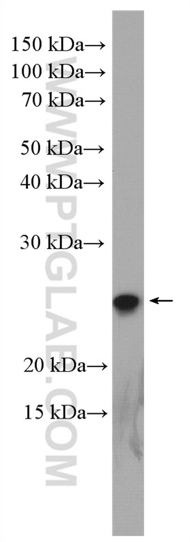 RPE Antibody in Western Blot (WB)