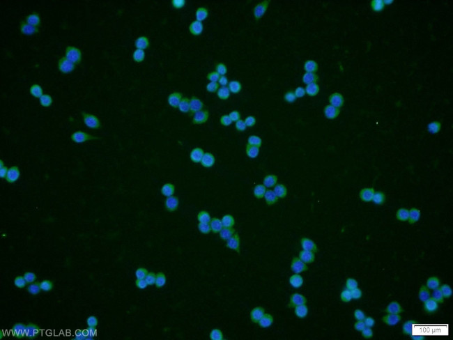 RPE Antibody in Immunocytochemistry (ICC/IF)