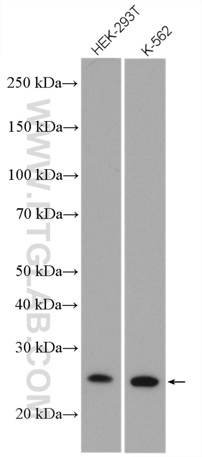 RPE Antibody in Western Blot (WB)