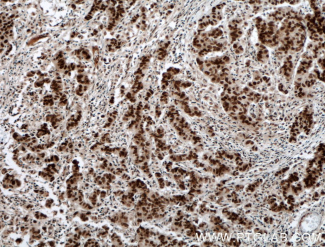 RTF1 Antibody in Immunohistochemistry (Paraffin) (IHC (P))