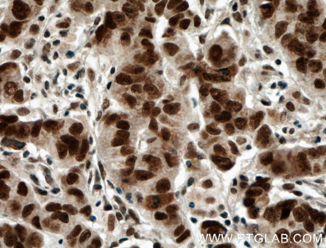 RTF1 Antibody in Immunohistochemistry (Paraffin) (IHC (P))