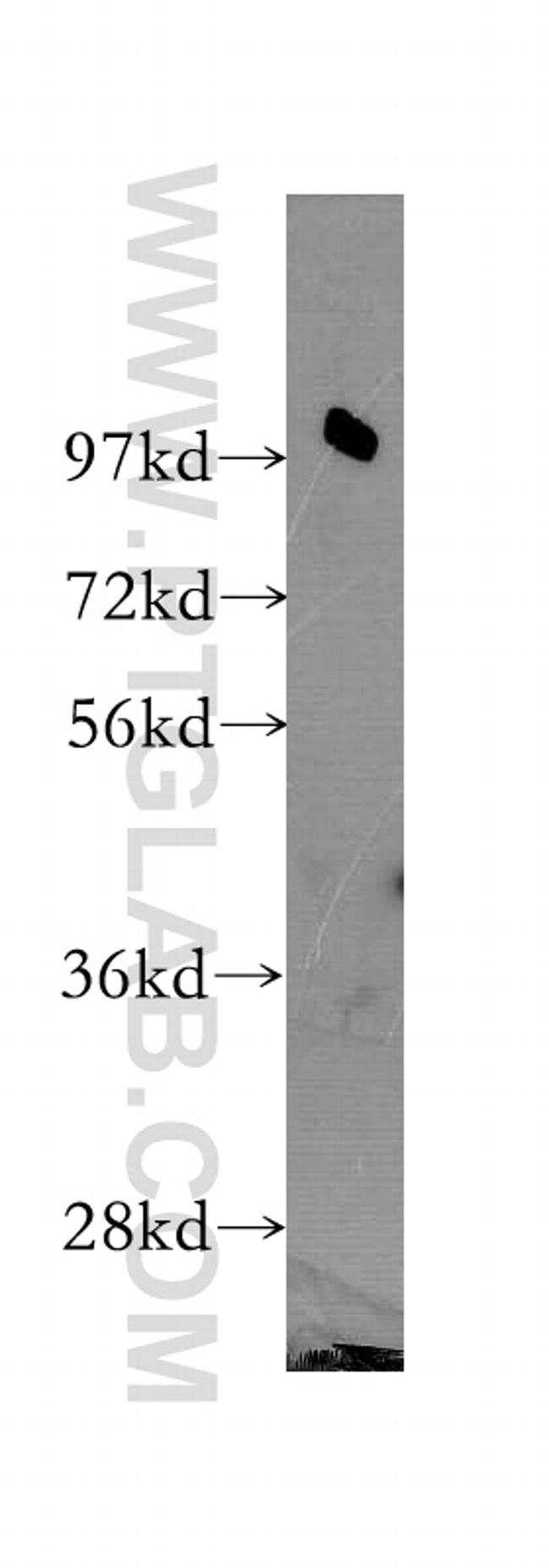 RTF1 Antibody in Western Blot (WB)