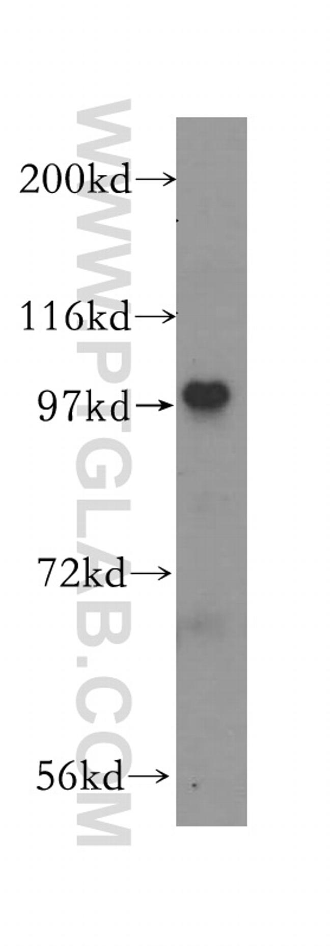 RTF1 Antibody in Western Blot (WB)