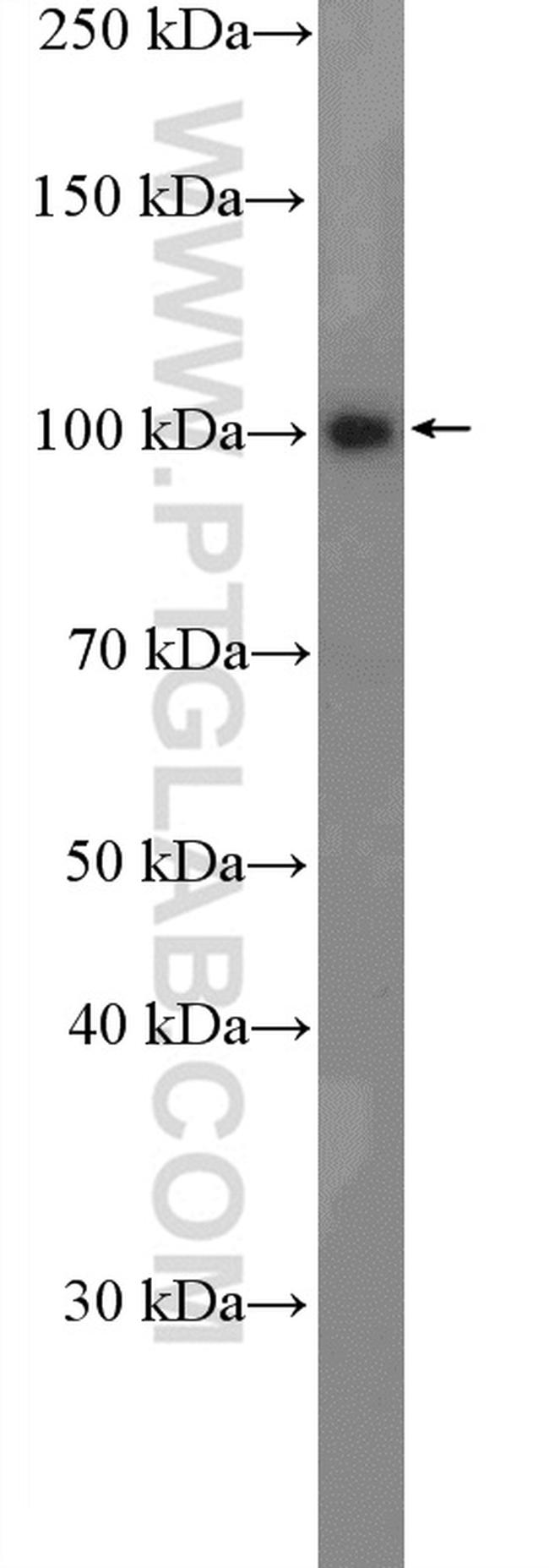 RTF1 Antibody in Western Blot (WB)