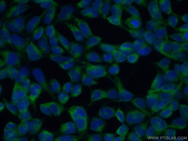 FKBP65 Antibody in Immunocytochemistry (ICC/IF)