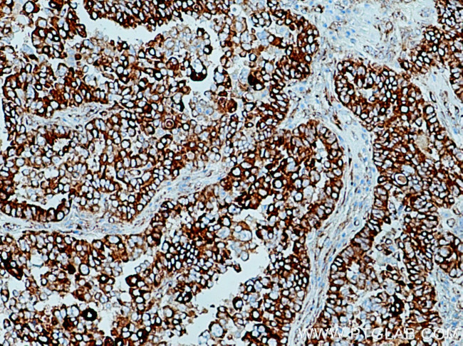 FKBP65 Antibody in Immunohistochemistry (Paraffin) (IHC (P))