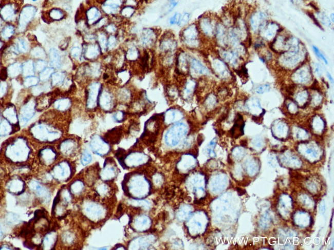 FKBP65 Antibody in Immunohistochemistry (Paraffin) (IHC (P))