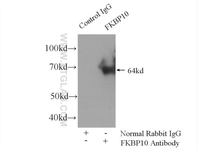 FKBP65 Antibody in Immunoprecipitation (IP)