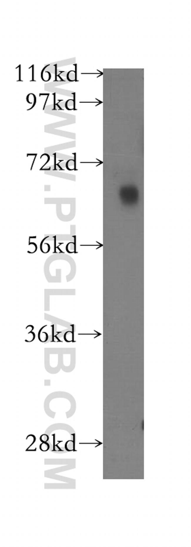 FKBP65 Antibody in Western Blot (WB)