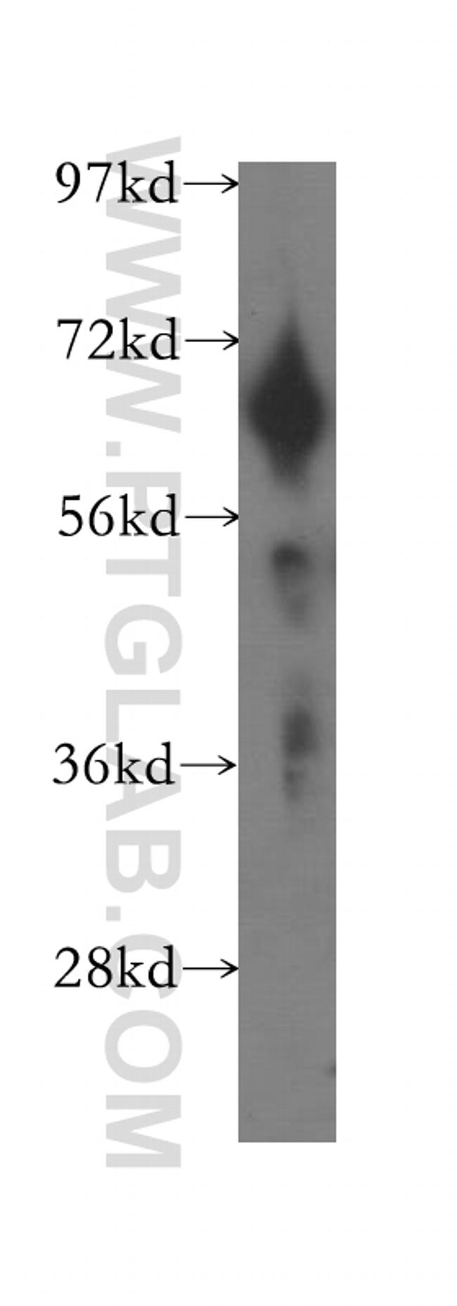 FKBP65 Antibody in Western Blot (WB)