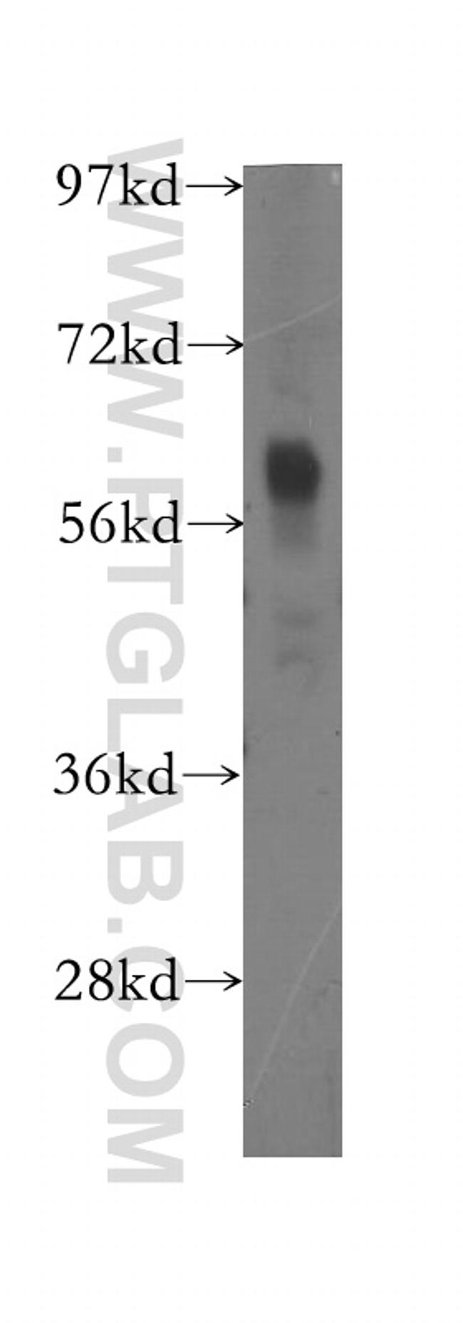 FKBP65 Antibody in Western Blot (WB)