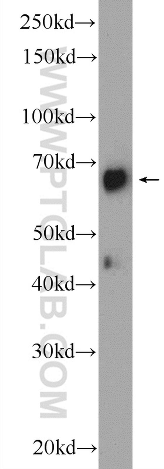 FKBP65 Antibody in Western Blot (WB)