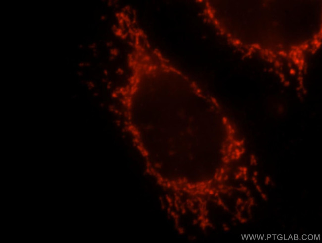 OXCT1 Antibody in Immunocytochemistry (ICC/IF)