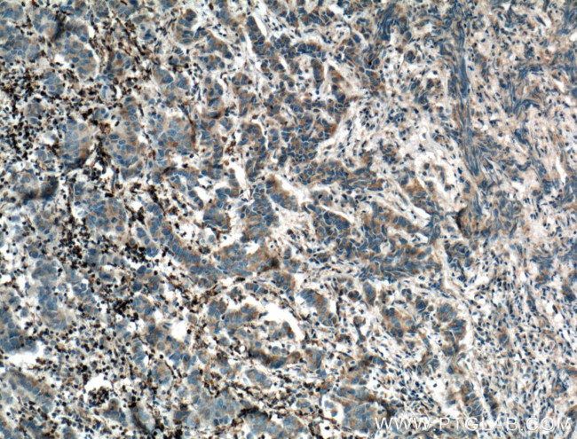 OXCT1 Antibody in Immunohistochemistry (Paraffin) (IHC (P))