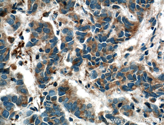 OXCT1 Antibody in Immunohistochemistry (Paraffin) (IHC (P))