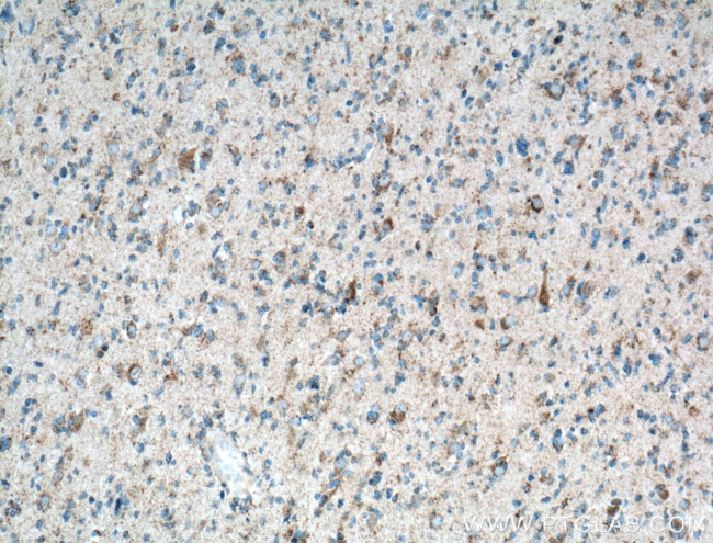 OXCT1 Antibody in Immunohistochemistry (Paraffin) (IHC (P))