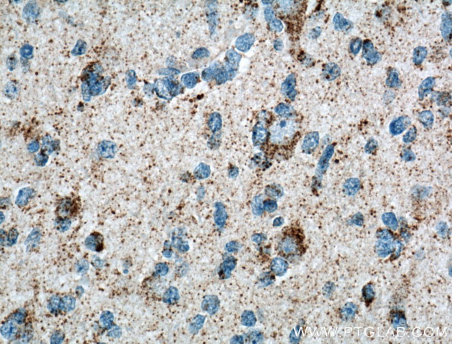 OXCT1 Antibody in Immunohistochemistry (Paraffin) (IHC (P))