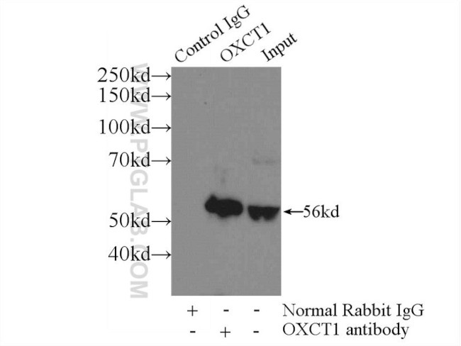 OXCT1 Antibody in Immunoprecipitation (IP)