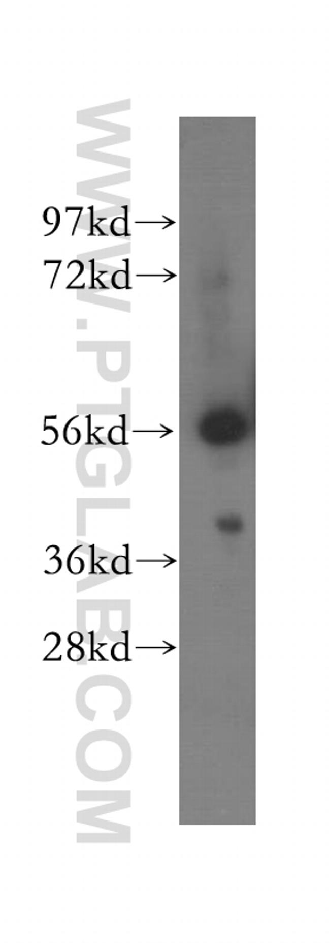 OXCT1 Antibody in Western Blot (WB)