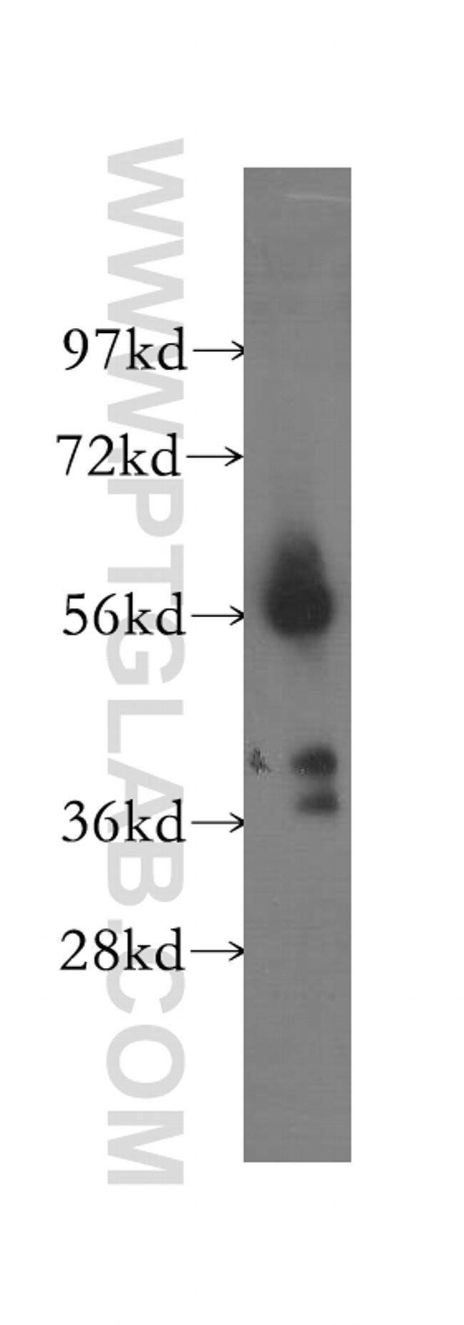 OXCT1 Antibody in Western Blot (WB)