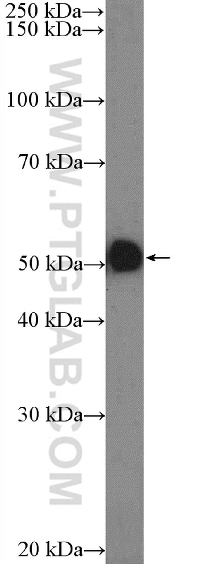 OXCT1 Antibody in Western Blot (WB)