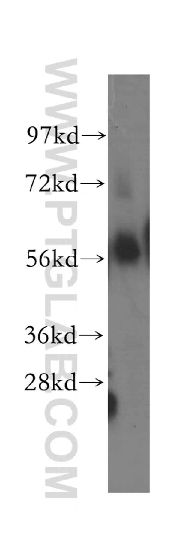 OXCT1 Antibody in Western Blot (WB)