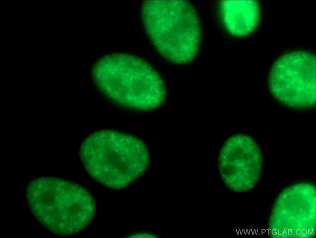 SMNDC1 Antibody in Immunocytochemistry (ICC/IF)