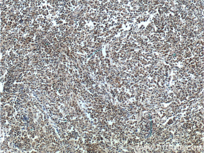 SMNDC1 Antibody in Immunohistochemistry (Paraffin) (IHC (P))