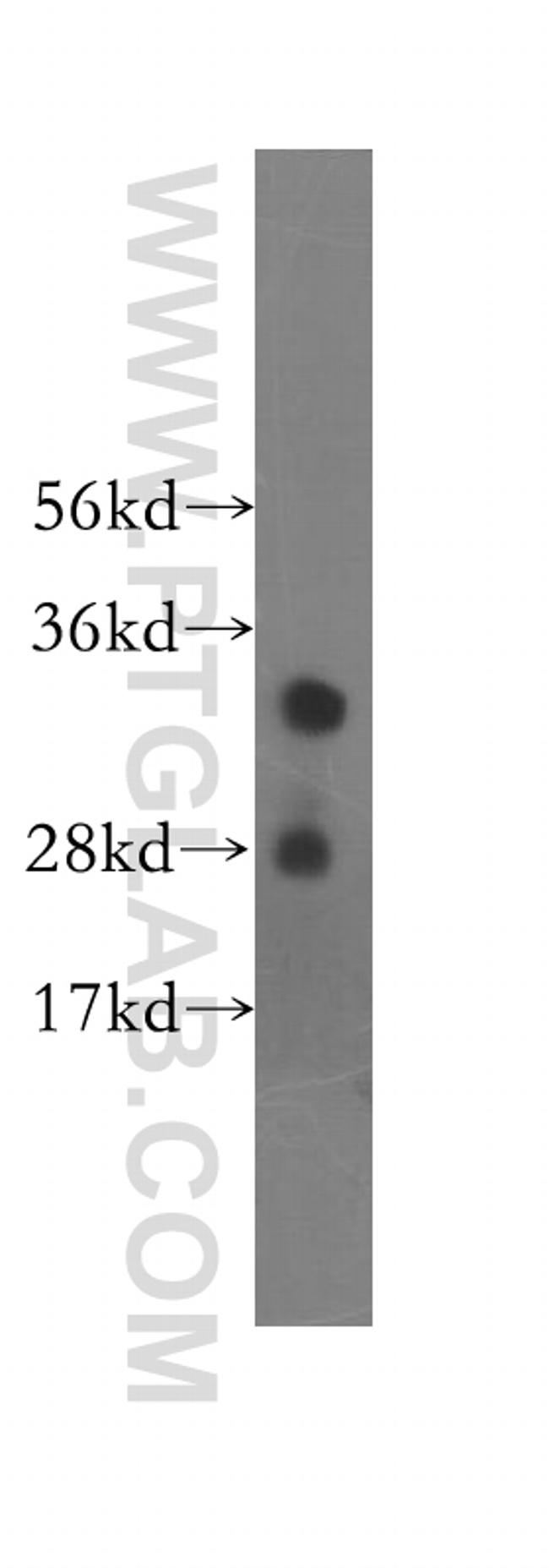 SMNDC1 Antibody in Western Blot (WB)