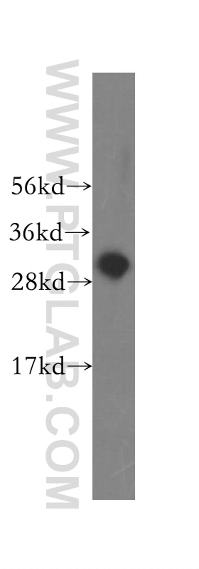 SMNDC1 Antibody in Western Blot (WB)