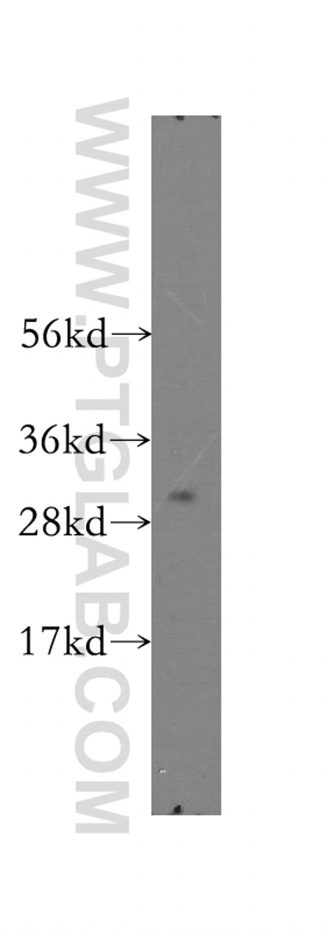 SMNDC1 Antibody in Western Blot (WB)