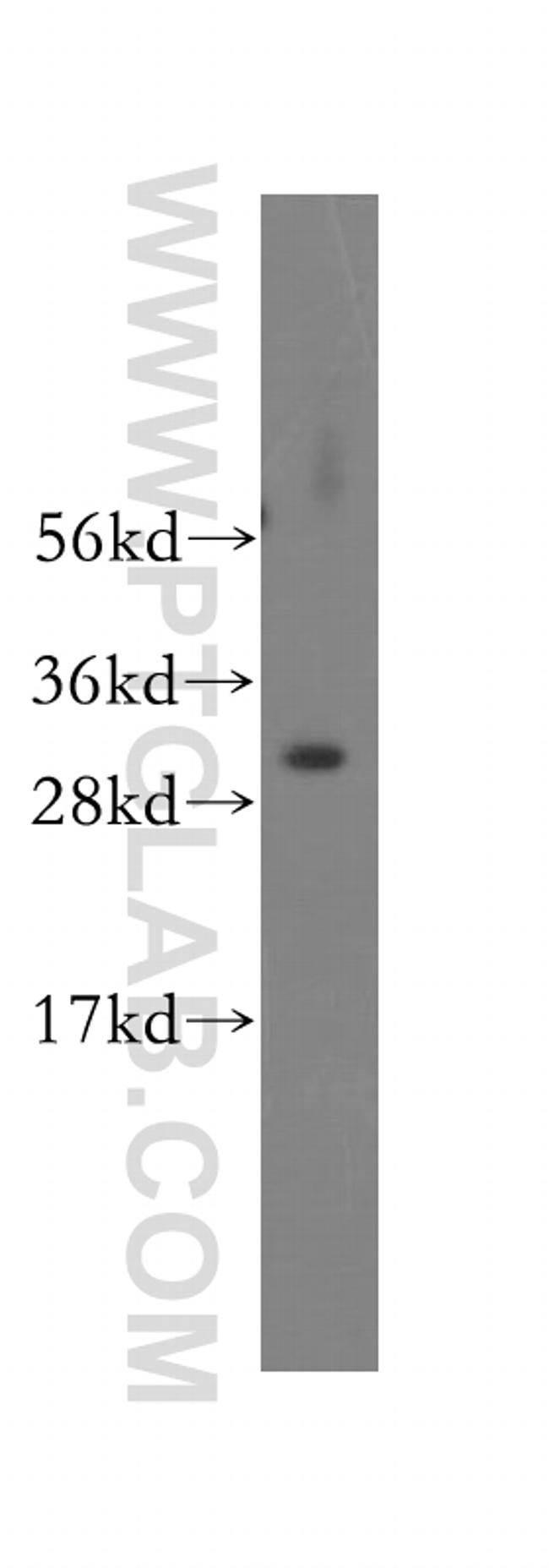 SMNDC1 Antibody in Western Blot (WB)