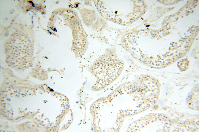 MT3 Antibody in Immunohistochemistry (Paraffin) (IHC (P))