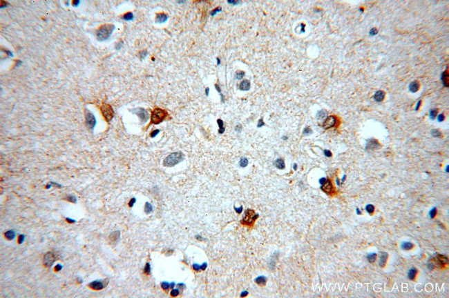 MT3 Antibody in Immunohistochemistry (Paraffin) (IHC (P))