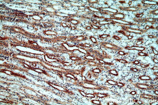 MT3 Antibody in Immunohistochemistry (Paraffin) (IHC (P))