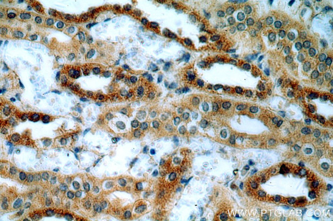 MT3 Antibody in Immunohistochemistry (Paraffin) (IHC (P))