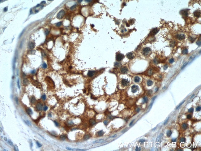 MT3 Antibody in Immunohistochemistry (Paraffin) (IHC (P))