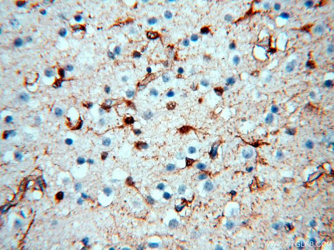 MT3 Antibody in Immunohistochemistry (Paraffin) (IHC (P))