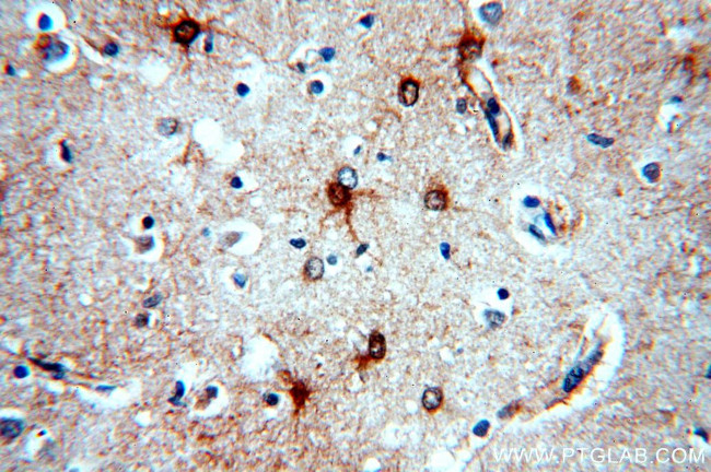 MT3 Antibody in Immunohistochemistry (Paraffin) (IHC (P))