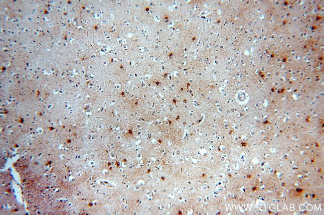 MT3 Antibody in Immunohistochemistry (Paraffin) (IHC (P))