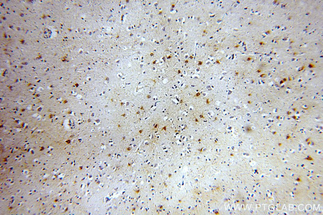 MT3 Antibody in Immunohistochemistry (Paraffin) (IHC (P))